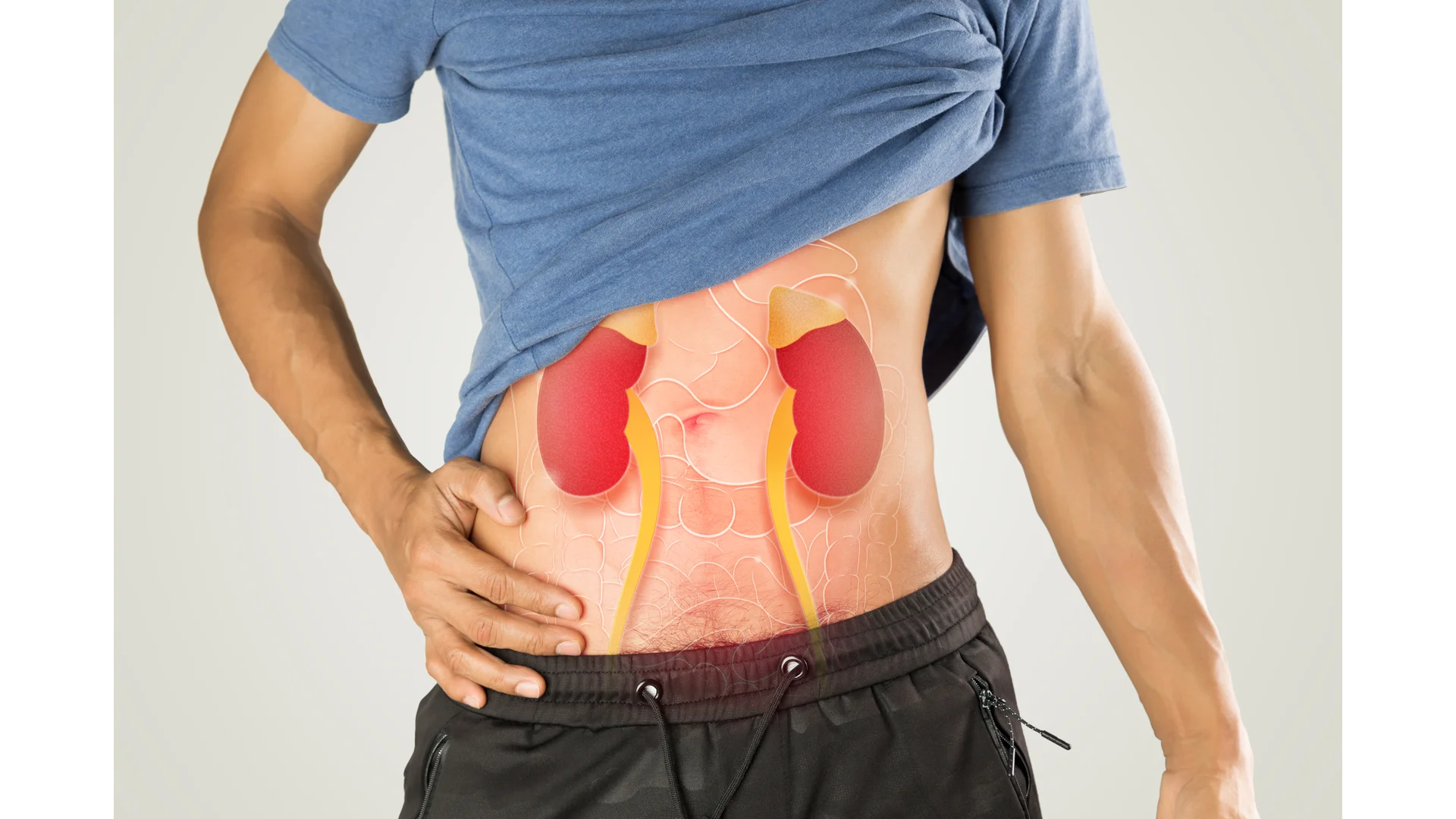 Renal and Upper Urinary tract Conditions